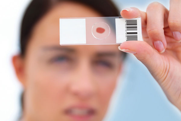 Doctor examining blood sample