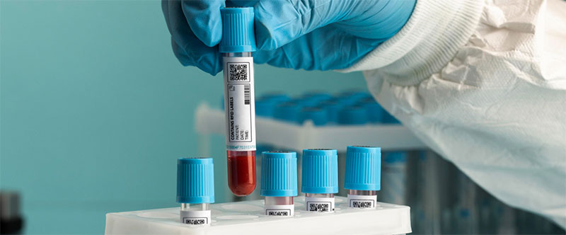 Etichetta sul campione di sangue
